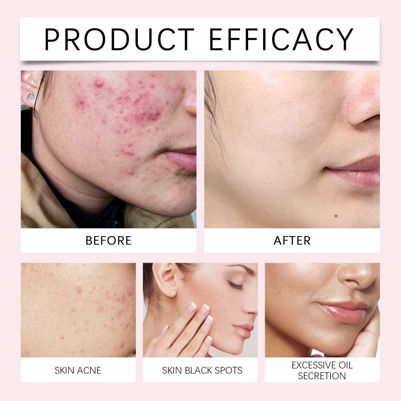 Shiva™ Kurkuma Kojic reinigingspads