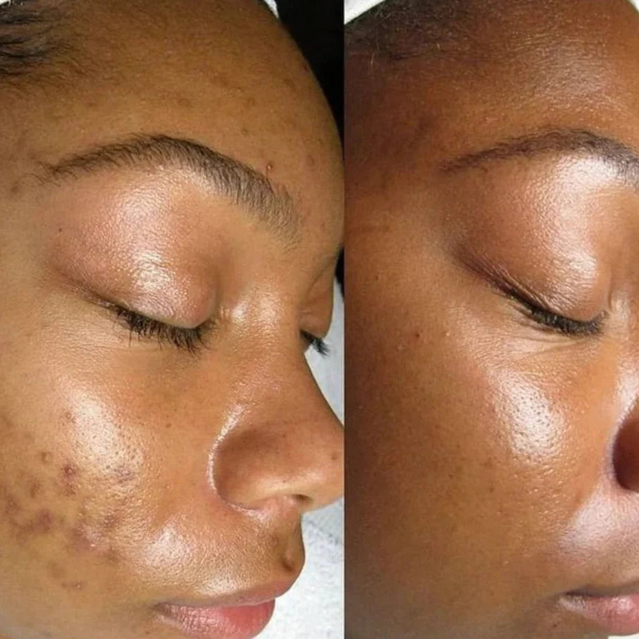 Shiva™ GlowBar Soap 1+1 Free