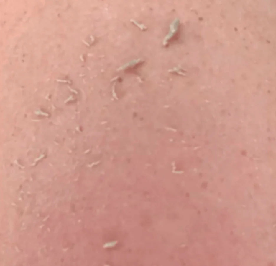 Shiva™ Soft Scrub Bundel